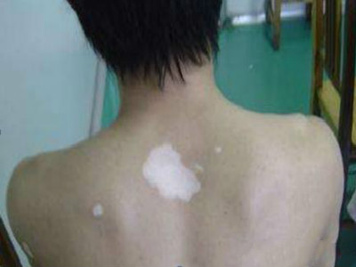https://bft.zoosnet.net/LR/Chatpre.aspx?id=BFT51738171&p=baikezh&e=baikezh